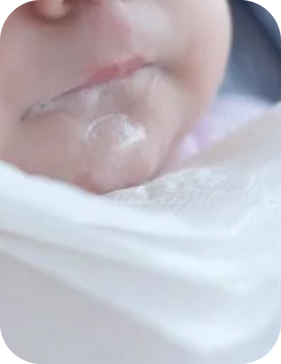 Baby with reflux while sleeping