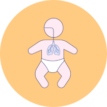 Respiratory Symptoms of Cow'S Milk Protein Allergy.